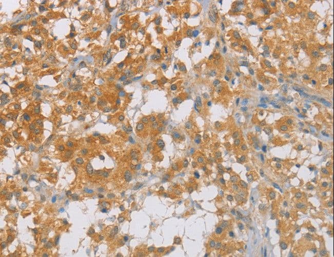 Polyclonal Rabbit anti-Human p16INK4a / CDKN2A Antibody (IHC)