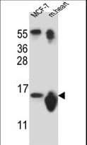 IHC-plus™ SNRPD3 Antibody (aa9-38)
