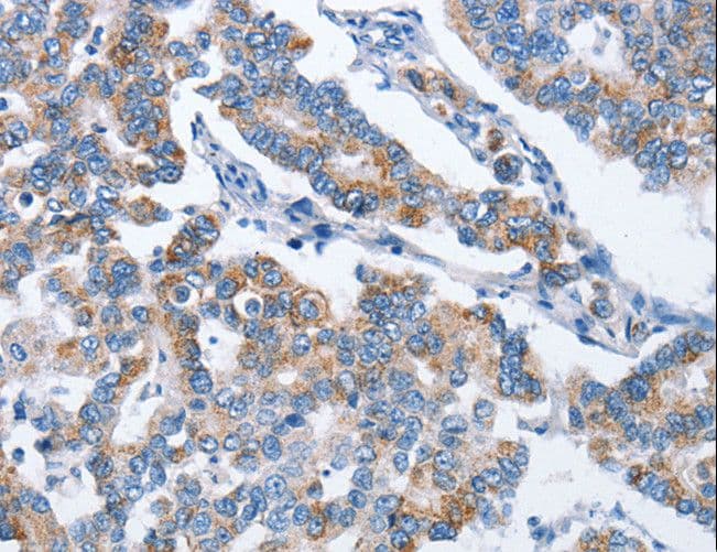 CHDH / CHD Antibody
