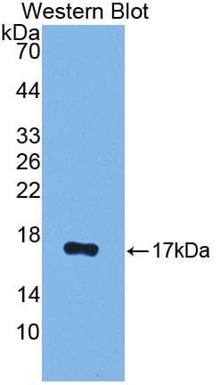 PR / Progesterone Receptor Antibody (aa672-790)