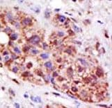 HR6B / UBE2B Antibody (aa117-146)