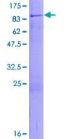 Human ZNHIT6 / C1orf181 Protein (Recombinant GST)