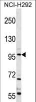 TRPC4 Antibody (aa812-840)