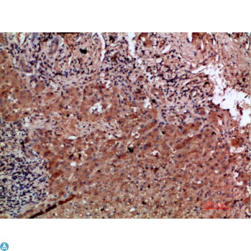 CLEC4C / CD303 / BDCA-2 Antibody