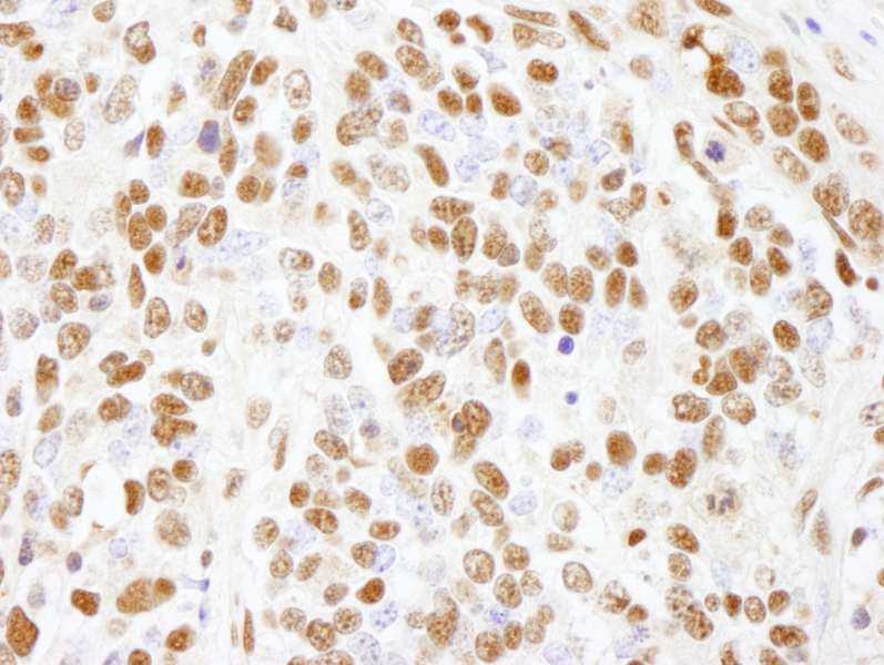 Polyclonal Rabbit anti-Human CTR9 Antibody (aa1123-1173, IHC)