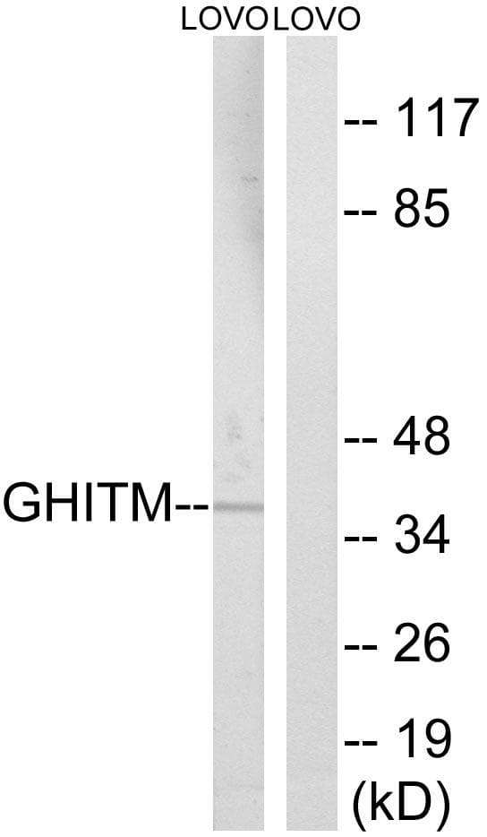 GHITM Antibody