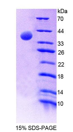 Mouse MTFMT Protein (Recombinant His-T7)