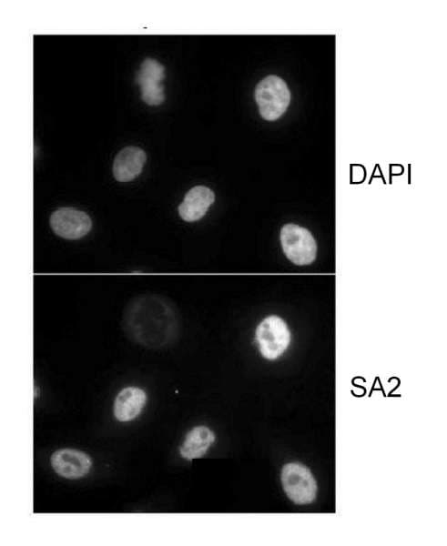 IHC-plus™ Polyclonal Goat anti-Human STAG2 Antibody (aa1100-1150, IHC, WB)