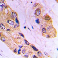 DHRS4 / PSCD Antibody (C-Terminus)