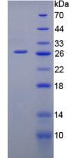 Mouse GPI Protein (Recombinant His-T7)