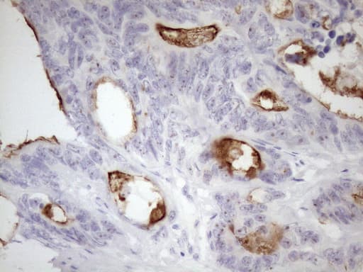 Monoclonal Mouse anti-Human SSX2IP Antibody (clone OTI9B2, aa1-272, IHC, WB)