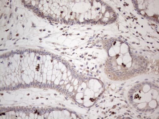 AMTN Antibody (clone OTI1D6)