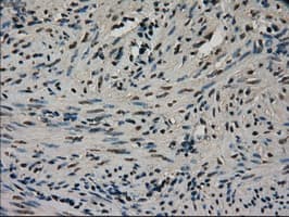CTAG1B / NY-ESO-1 Antibody (clone OTI3C9)