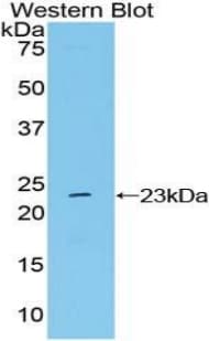 NME6 Antibody (aa1-184, APC)