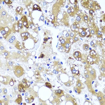 IL4 Antibody