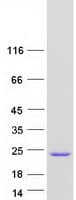 Human POLE3 / DNA Polymerase Epsilon Protein (Recombinant Myc-DDK (Flag))