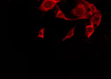 Polyclonal Rabbit anti-Human OR10G4 Antibody (IF, WB)