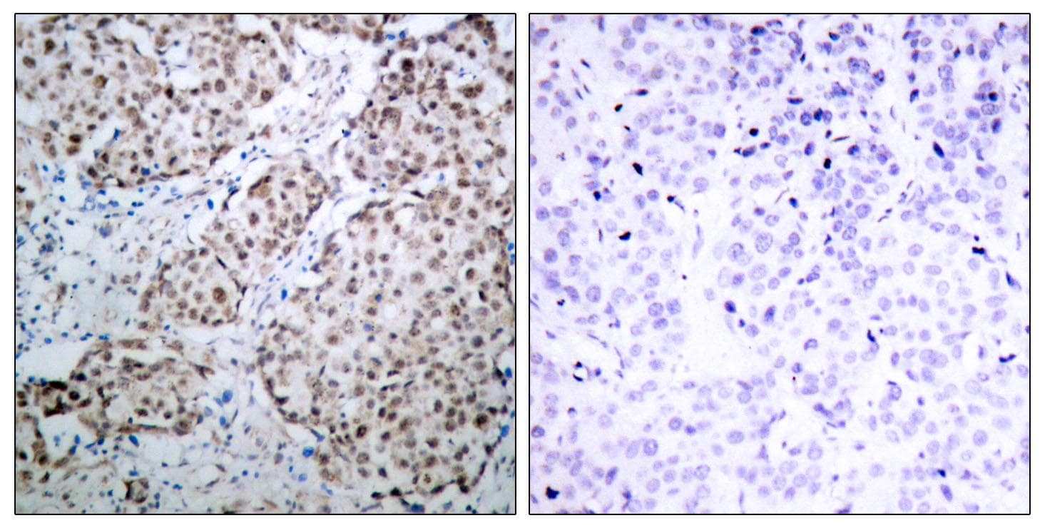 TP53 / p53 Antibody (phospho-Ser315)