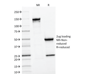 CD22 Antibody (clone BLCAM/1796)