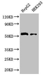 LDHD / Lactate Dehydrogenase D Antibody