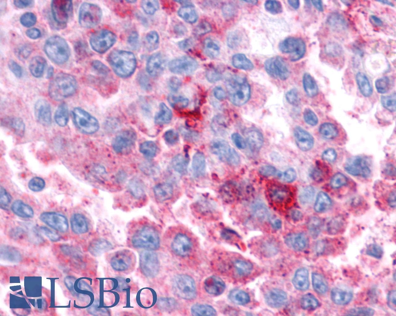 PathPlus™ Polyclonal Rabbit anti-Human VIPR1 Antibody (Cytoplasmic Domain, IHC)
