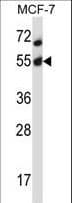 IHC-plus™ AKT2 Antibody (aa93-122)