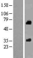SOAT2 Protein (Over-Expression Lysate Myc-DDK (Flag))