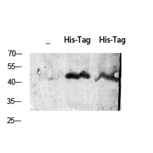 Polyclonal Rabbit His Tag Antibody (WB)