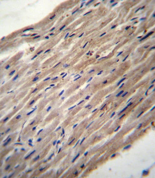 PLOD / PLOD1 Antibody (aa66-94)