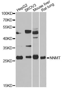 Polyclonal Rabbit anti-Human NNMT Antibody (IF, WB)