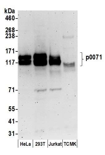 Polyclonal Rabbit anti-Human PKP4 / Plakophilin 4 Antibody (aa1-50, WB)