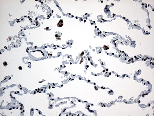 GTF3C4 Antibody (aa583-822, clone OTI4A1)
