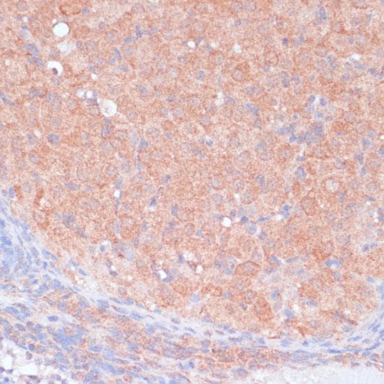 LRP1 / CD91 Antibody