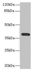 Polyclonal Rabbit anti-Human DNAM-1 / CD226 Antibody (IHC, WB)