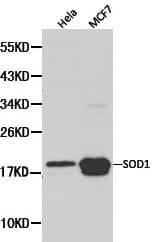 Polyclonal Rabbit anti-Human SOD1 / Cu-Zn SOD Antibody (IHC, WB)