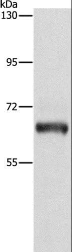 Polyclonal Rabbit anti-Human KLC1 / Kinesin Light Chain 1 Antibody (IHC, WB)