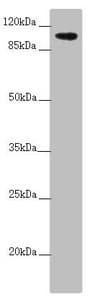 Polyclonal Rabbit anti-Human TTLL7 Antibody (IHC, WB)