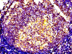Polyclonal Rabbit anti-Human CXCR5 Antibody (IHC, IF)