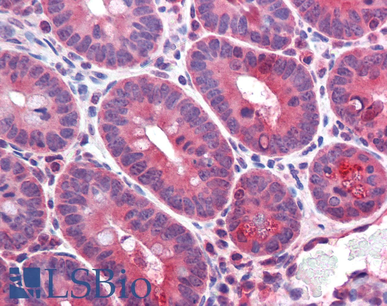 IHC-plus™ CD36 Antibody (aa99-114)