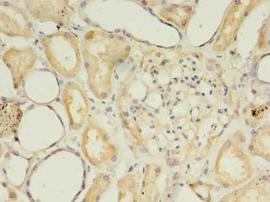 Polyclonal Rabbit anti-Human SFXN2 Antibody (IHC)