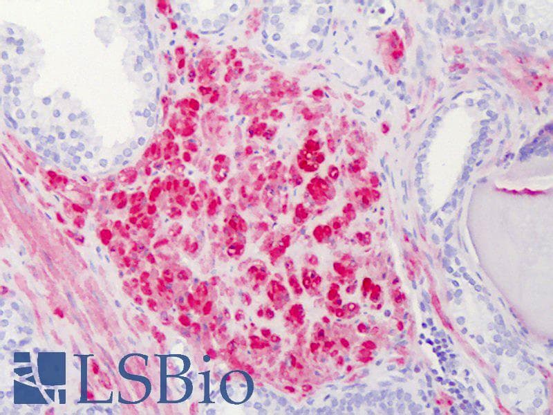 IHC-plus™ Monoclonal Mouse anti-Human CNN1 / Calponin Antibody (clone 2F5-1H4, IHC, WB)