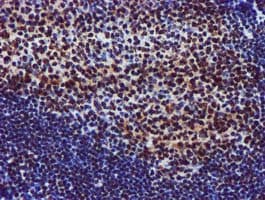 GSTT2 Antibody (clone OTI3B6)