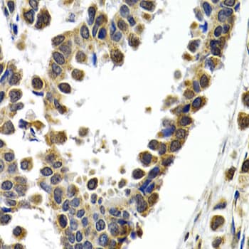 ATF2 Antibody