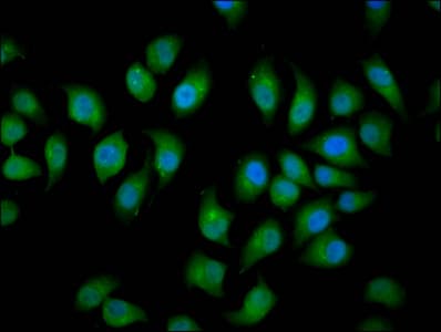 Polyclonal Rabbit anti-Human NEDL2 / HECW2 Antibody (IHC, IF, WB)