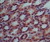 IL17RE Antibody (clone 46N7E3)