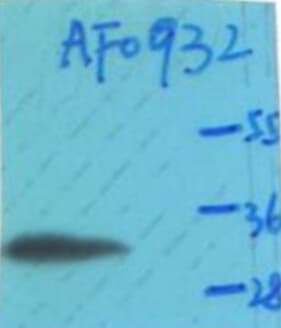 CCND1 / Cyclin D1 Antibody (phospho-Thr286)