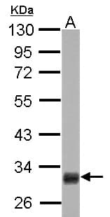 Polyclonal Rabbit anti-Human HMGCL Antibody (aa1-325, IHC, WB)