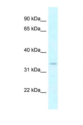 Polyclonal Rabbit anti-Human DHRSX Antibody (aa32-81, WB)