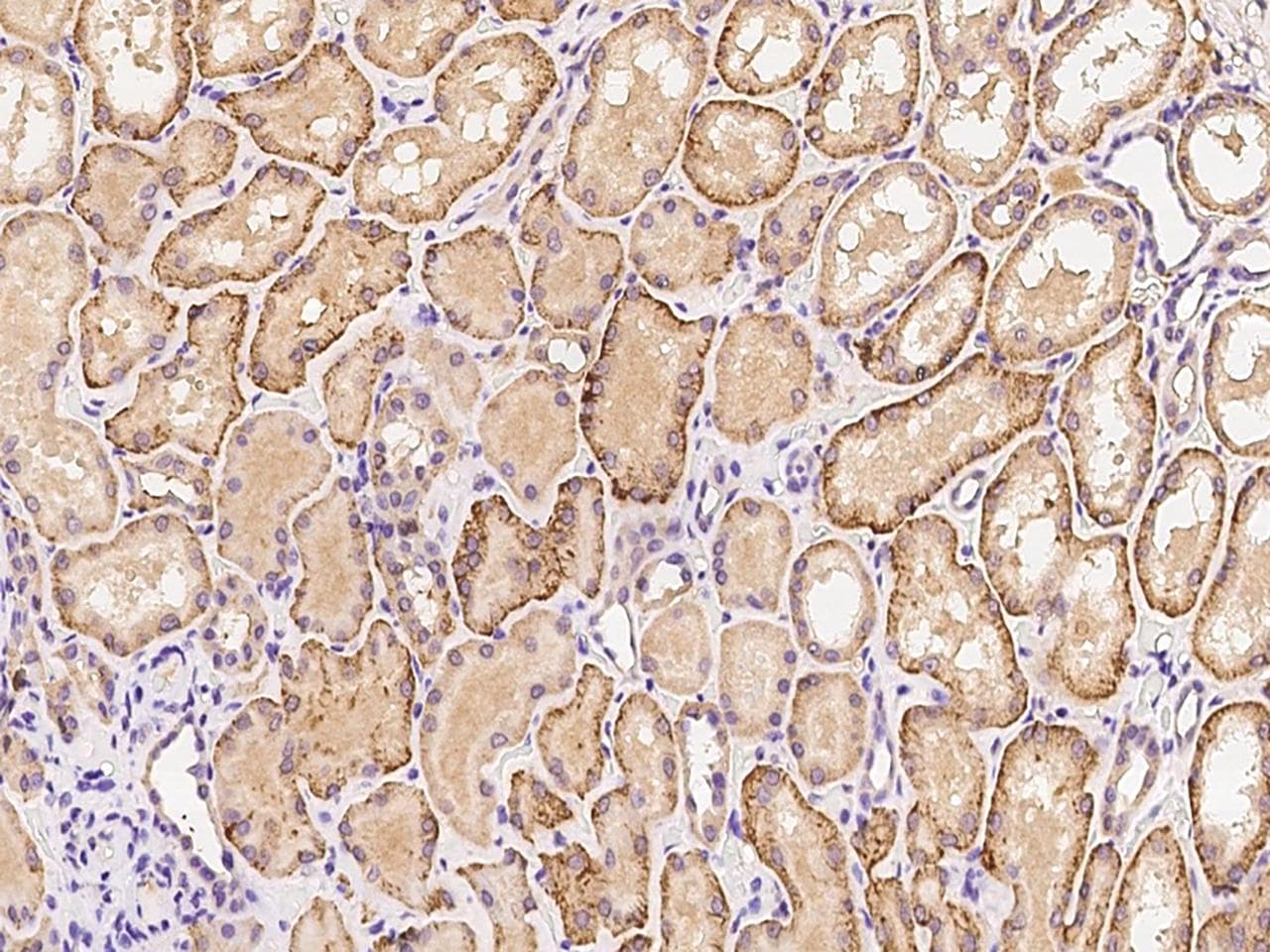 ITIH3 Antibody