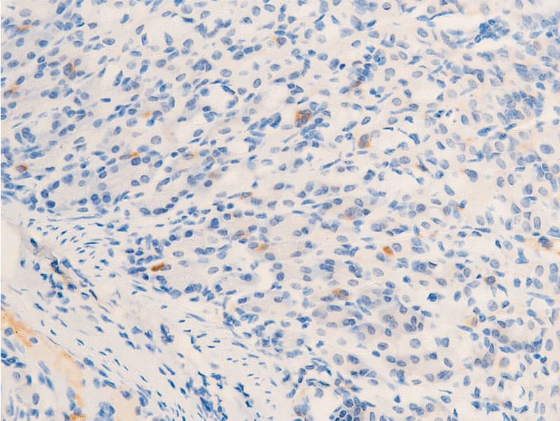 ERBB2 / HER2 Antibody (phospho-Tyr877)